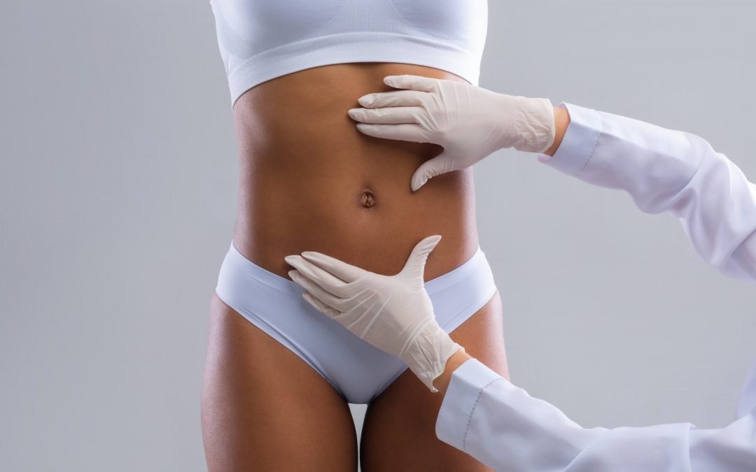 Qual o peso ideal para fazer uma lipoaspiração?