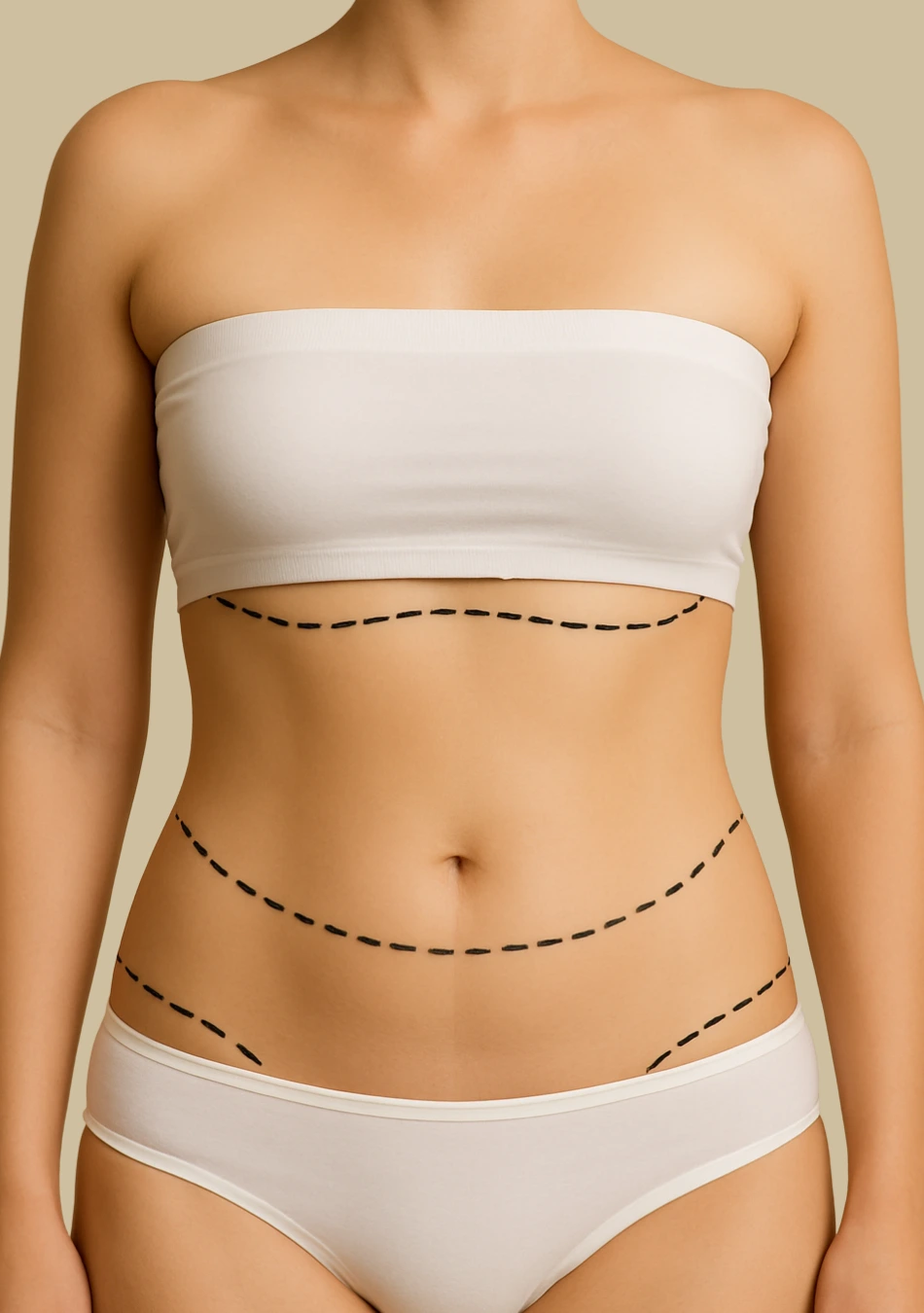 Abdominoplastia reversa